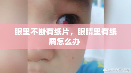 眼里不断有纸片，眼睛里有纸屑怎么办 