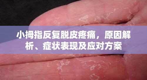 小拇指反复脱皮疼痛，原因解析、症状表现及应对方案